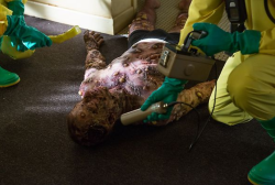 I wouldn't wish this on my worst enemy...except that one guy...nah, this is just nasty.